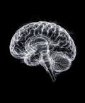 EXPOSED Brain high-detail X-ray artwork